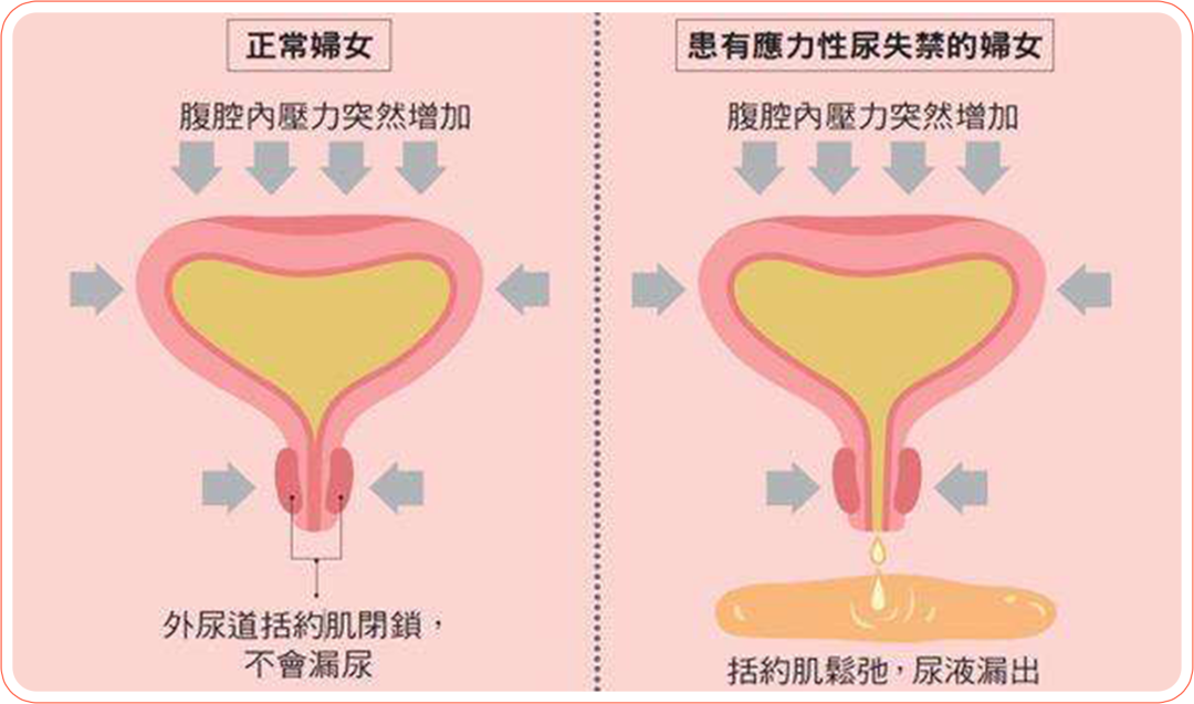 1668068148501419.png 3.png